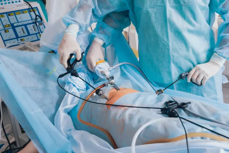 Laparoscopic Gynecological Surgeries